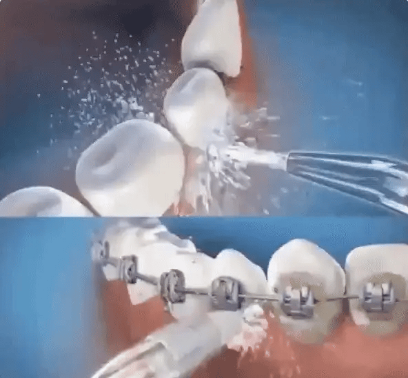 🪥LIMPIADOR Bucal Portátil Power Max 4X1!🦷 LIMPIEZA PROFUNDA Y ENCIAS MÁS SALUDABLES, CON ENVIO GRATIS🚚