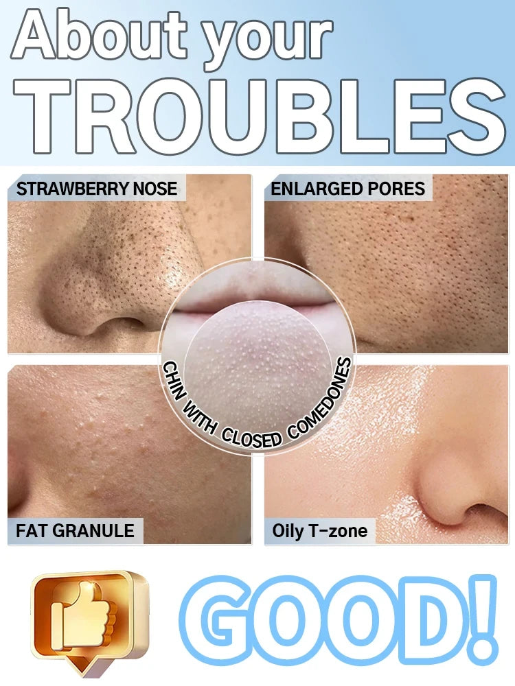 Limpiador de Poros Facial